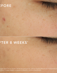 C-Bright Dark Spot Corrector