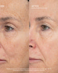 SeneCell™ SenePlex+® StemCell Concentrate
