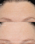 SeneCell™ SenePlex+® StemCell Concentrate